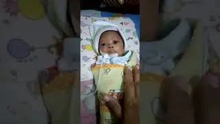 bayi prematur 28 minggu berat lahir 900gram