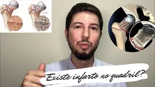 Existe Infarto no Quadril? Principais causas da osteonecrose da cabeça do fêmur. Dr Rafael Tavares