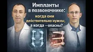 Правда об имплантах в позвоночнике: ошибки, риски и что скрывают от пациентов