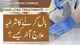 Hair Loss Treatment, Balon K Girnay Ka Ilaj! | By Cureall Medical Centre