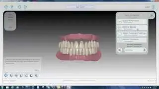 Avadent Digital Dentures Promo