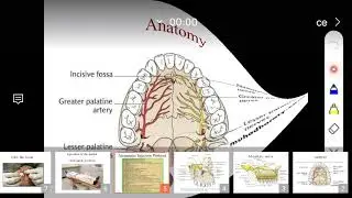 surgery 1 (innervation of upper teeth +injection protocol of local anesthesia)