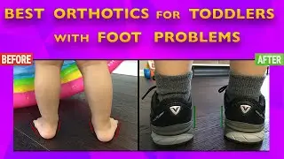 Top 2 Orthotics for Toddlers with Foot Issues - Flat Feet, Pronation, Toe-Walking, and Weak Ankles
