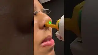 Красное пятно на носу, которое никак не проходит #шорты #дерматолог