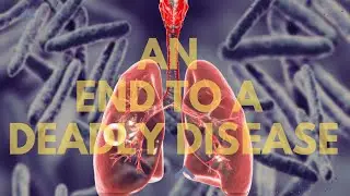 ಹಾವರಗಿ ಇನ್ನೂ ಕ್ಷಯರೋಗ  ಮುಕ್ತ ಗ್ರಾಮ #ntep,#tuberculos,#tbawareness #tbelimination,#eliminatetb