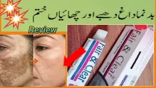 Removing hyper pigmentation cream| Fair and clear cream for pigmentation darkness skin cream review.
