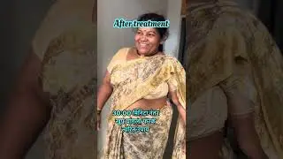Sciatica pain solve 1st setting 90% results no medicine no injection no 