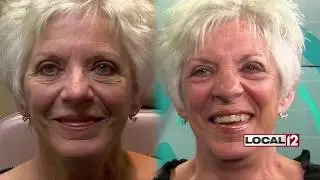 Liz Bonis Follow Christine on her Natural Advanced Facelift, Eyelid Surgery and Chin Implant pro...
