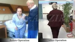 Hacer KENKUL-Before and After Surgery Parkinson's Treatment DBS in Turkey Surgery Date 16.05.2013