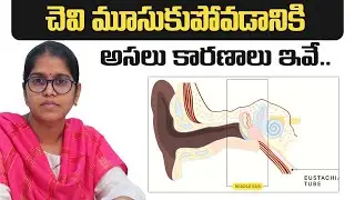 చెవి మూసుకుపోవడానికి అసలు కారణాలు ఇవే| What Are The Causes Of Ear Block |Dr Harika ENT Care Hospital