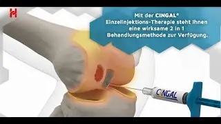 CINGAL&reg; ist eine einzigartige und wirksame Einzelinjektionstherapie bei entz&uuml;ndlicher #Arthrose