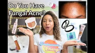 Fungal Acne Safe Make-Up Routine: How to Get Rid of Those Little Bumps