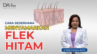 Cara Mudah Menyamarkan Flek Hitam | Bincang Sehati