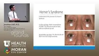 Differential Diagnosis for Painful Horner's Syndrome