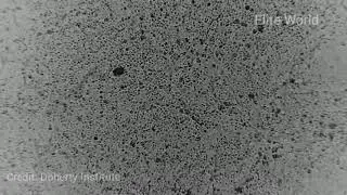 Corona virus microscopic look, Doherty Institute Scientists were first to grow