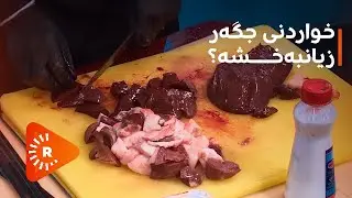 Dr Aras- دکتۆر ئاراس- راستە دەگوترێت خواردنی جگەر زیانبەخشە؟