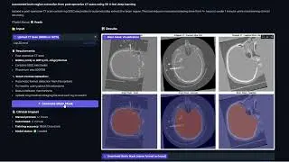 Automatic Brain Segmentation from Post-Operative CT Scans | AI Demo