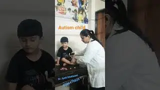 Autism child #youtubeshorts #youtube #doctor #treatment #acupressure