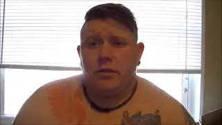 FTM 2+ Years on T/Top Surgery Update