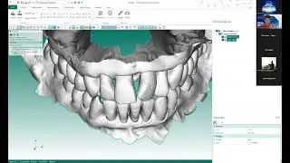 Webinar | L&agrave;m chủ phần mềm DAD &ndash; Direct Aligner Design | 11.01.2026