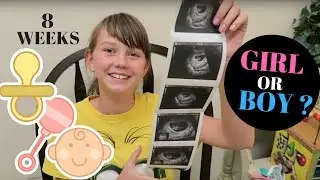 First Ultrasound 8 weeks Boy Or Girl?