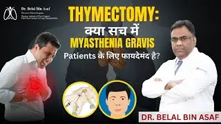 Thymectomy: क्या Myasthenia Gravis के मरीजों के लिए है फायदेमंद? जानें सच्चाई - Dr Belal Bin Asaf