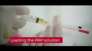 Tired of seeing thinning hair? Get Your PRP Hair Treatment at Genesis Clinic #prp #hairtransplant