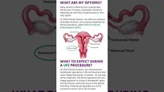 What Kind of Fibroids Do You Have? Dr. Shiloh Explains How to Decode Your Ultrasound #Fibroids #UFE