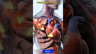 Heart Attack Warning Signs You Should Never Ignore ❤️ #Shorts