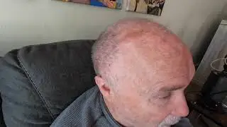 My Normal Pressure Hydrocephalus Video #3