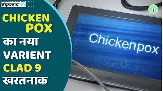 Chickenpox Clade 9 | भारत में मिला चिकनपॉक्स का नया वेरिएंट | Symptoms of Chickenpox Clade 9