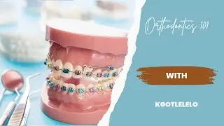 S1EP3: Orthodontics 101 with Kgotlelelo - Why I decided to get braces - *GIVEAWAY*
