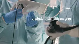 أطباء مستشفى كليفلاند كلينك – أبوظبي، يشرحون حالة مريضة تعاني سرطاناً في القولون | برنامج #عمر_جديد