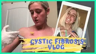 PORT ACCESS + LOSING CF FRIENDS - A CYSTIC FIBROSIS VLOG