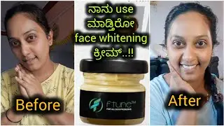 ನಾನು use ಮಾಡ್ತಿರೋ face whitening cream..?? ftune night cream / difference ನೀವೇ ನೋಡಿ./14 days result