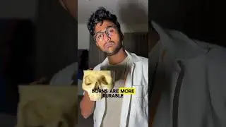 Original bone set vs artificial bone set #mbbs1styear #mbbs