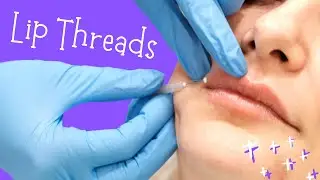Why You Might Want To Try Lip Threads | Drs Discuss