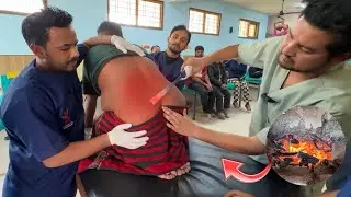 Knee Pain & Spine Pain Ka Permanent Solution? 😱 | Ayurveda Agnikarma 🔥