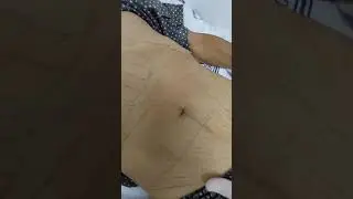 Topography of the abdomen