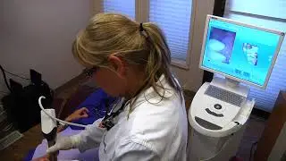 ABQ Dentists--Cerec Crowns