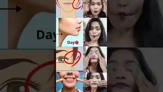 Facefatloose skinyoga health #faceyoga#brightskin #yogaasanas #glowingskin #shorts #viralvideo
