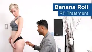 Med Spa Radio Frequency (RF) Treatment - Patient Testimonial