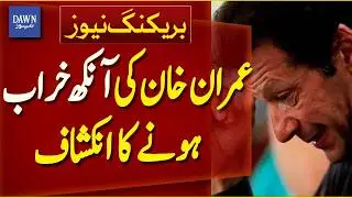 Shocking Revelation: Imran Khan&rsquo;s Eye Problem Exposed | Breaking News | Dawn News