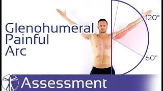 Painful Arc Sign | Subacromial Pain Syndrome (SAPS)