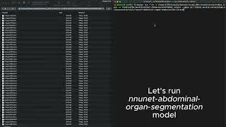 nnUNet