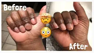 How To | Get RID of “Green Nails” Bacteria FAST !! 😳🤭🙄