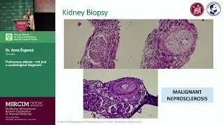 Pulmonary edema - not just a cardiological diagnosis