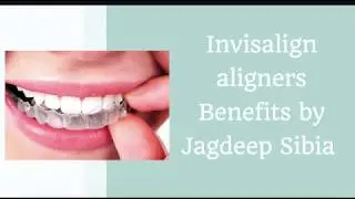 Jagdeep Sibia explains Invisalign aligners Benefits