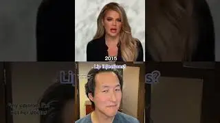 What Plastic Surgery Did Khloe Kardashian Get Over the Years? #shorts #khloekardashian