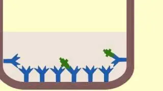 Enzyme immunoassay (EIA) to detect antigens - Multi-Lingual Captions